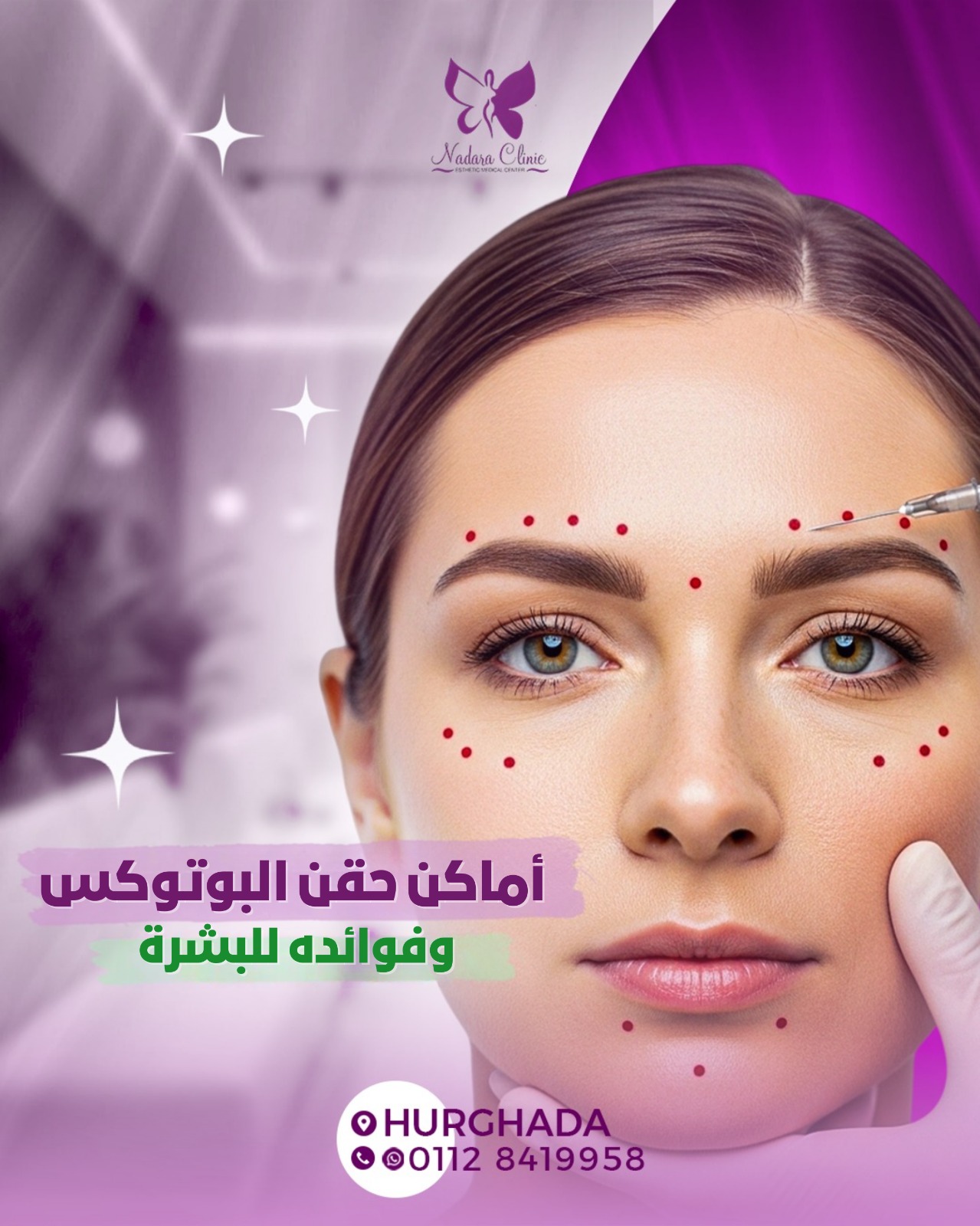 أماكن حقن البوتوكس | وفوائده للبشرة